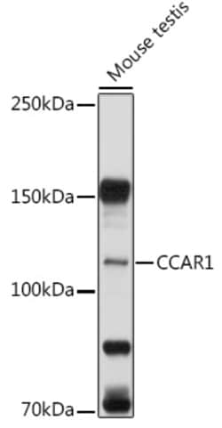 CCAR1 Polyclonal Antibody:Antibodies, Polyclonal