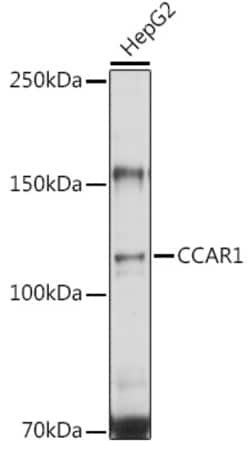 CCAR1 Polyclonal Antibody:Antibodies, Polyclonal