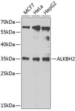 Invitrogen ALKBH2 Polyclonal Antibody 100 &mu;L; Unconjugated:Antibodies,