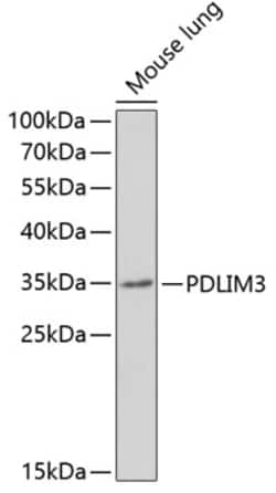 Invitrogen PDLIM3 Polyclonal Antibody 100 &mu;L; Unconjugated:Antibodies,
