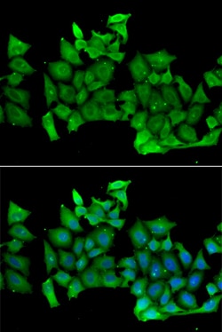 Invitrogen RhoH Polyclonal Antibody 100 &mu;L; Unconjugated:Antibodies,