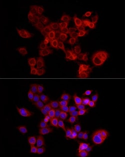 Invitrogen FABP5 Polyclonal Antibody 100 &mu;L; Unconjugated:Antibodies,