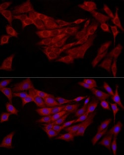 Invitrogen FABP5 Polyclonal Antibody 100 &mu;L; Unconjugated:Antibodies,