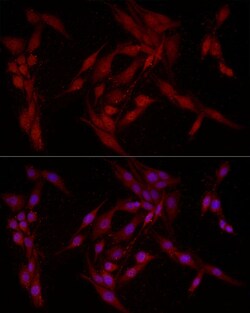 Invitrogen FABP5 Polyclonal Antibody 100 &mu;L; Unconjugated:Antibodies,