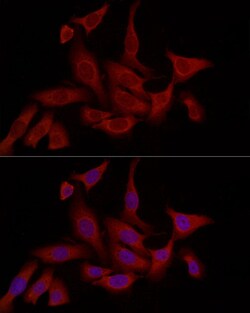 Invitrogen FABP5 Polyclonal Antibody 100 &mu;L; Unconjugated:Antibodies,
