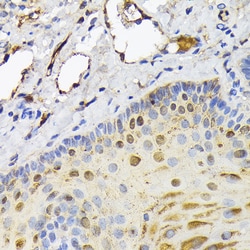 Invitrogen FABP5 Polyclonal Antibody 100 &mu;L; Unconjugated:Antibodies,