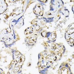 Invitrogen FABP5 Polyclonal Antibody 100 &mu;L; Unconjugated:Antibodies,