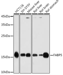 Invitrogen FABP5 Polyclonal Antibody 100 &mu;L; Unconjugated:Antibodies,