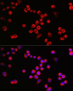 Invitrogen GAP43 Polyclonal Antibody 100 &mu;L; Unconjugated:Antibodies,