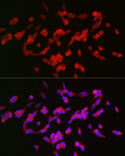 Invitrogen GAP43 Polyclonal Antibody 100 &mu;L; Unconjugated:Antibodies,