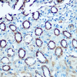 Invitrogen NDUFS4 Polyclonal Antibody 100 &mu;L; Unconjugated:Antibodies,