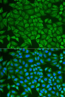 Invitrogen GCDFP-15 Polyclonal Antibody 100 &mu;L; Unconjugated:Antibodies,