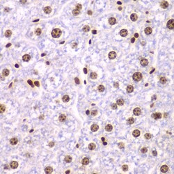 Invitrogen SSRP1 Polyclonal Antibody 100 &mu;L; Unconjugated:Antibodies,