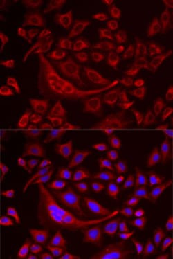 Invitrogen TUFM Polyclonal Antibody 100 &mu;L; Unconjugated:Antibodies,