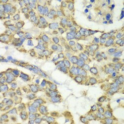 Invitrogen TUFM Polyclonal Antibody 100 &mu;L; Unconjugated:Antibodies,
