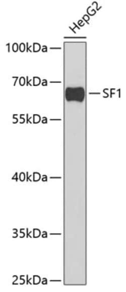 Invitrogen SF1 Polyclonal Antibody 100 &mu;L; Unconjugated:Antibodies,