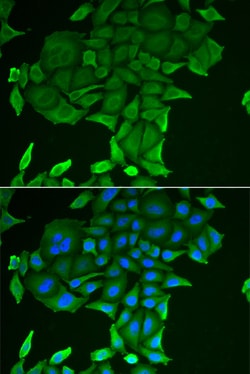 Invitrogen CD84 Polyclonal Antibody 100 &mu;L; Unconjugated:Antibodies,