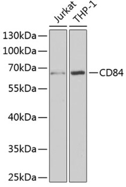 Invitrogen CD84 Polyclonal Antibody 100 &mu;L; Unconjugated:Antibodies,