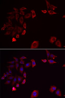 Invitrogen SKAP2 Polyclonal Antibody 100 &mu;L; Unconjugated:Antibodies,