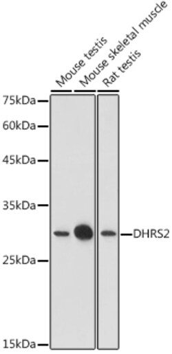 Invitrogen DHRS2 Polyclonal Antibody 100 &mu;L | Buy Online | Invitrogen&trade; | Fisher Scientific