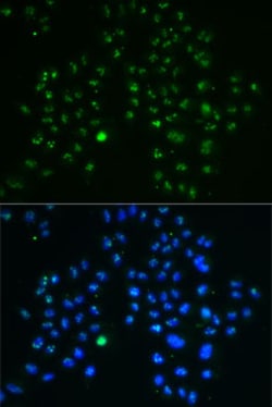 Nucleostemin Polyclonal Antibody:Antibodies, Polyclonal