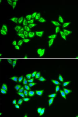 Invitrogen Bit1 Polyclonal Antibody 100 &mu;L; Unconjugated:Antibodies,