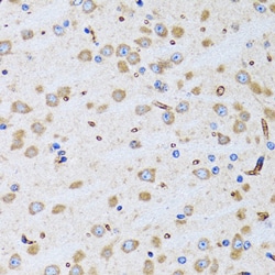 Invitrogen Bit1 Polyclonal Antibody 100 &mu;L; Unconjugated:Antibodies,