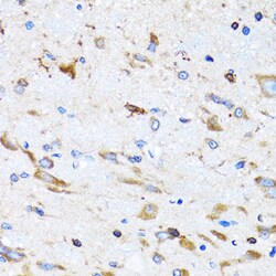 Invitrogen Bit1 Polyclonal Antibody 100 &mu;L; Unconjugated:Antibodies,