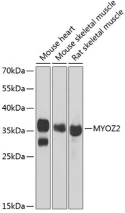 Invitrogen MYOZ2 Polyclonal Antibody 100 &mu;L | Buy Online | Invitrogen&trade; | Fisher Scientific
