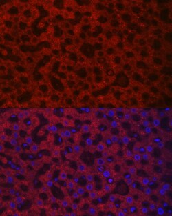 Invitrogen HAO1 Polyclonal Antibody 100 &mu;L; Unconjugated:Antibodies,