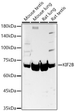 Invitrogen KIF2B Polyclonal Antibody 100 &mu;L | Buy Online | Invitrogen&trade; | Fisher Scientific