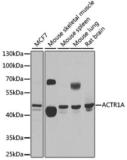 Invitrogen ACTR1A Polyclonal Antibody 100 &mu;L; Unconjugated:Antibodies,