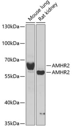 Invitrogen AMHR2 Polyclonal Antibody 100 &mu;L; Unconjugated:Antibodies,
