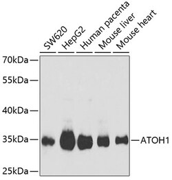 Invitrogen ATOH1 Polyclonal Antibody 100 &mu;L; Unconjugated:Antibodies,