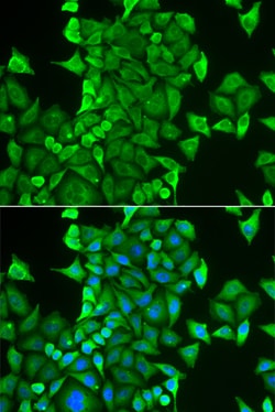 CARS Polyclonal Antibody:Antibodies, Polyclonal
