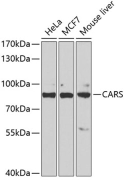 CARS Polyclonal Antibody:Antibodies, Polyclonal