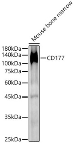 Invitrogen CD177 Polyclonal Antibody 100 &mu;L; Unconjugated:Antibodies,
