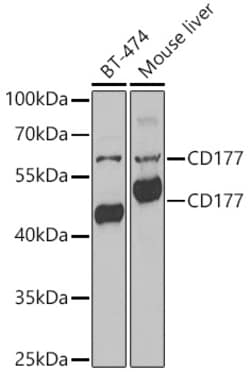 Invitrogen CD177 Polyclonal Antibody 100 &mu;L; Unconjugated:Antibodies,