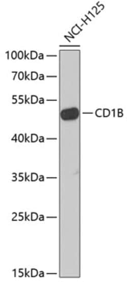 Invitrogen CD1b Polyclonal Antibody 100 &mu;L | Buy Online | Invitrogen&trade; | Fisher Scientific