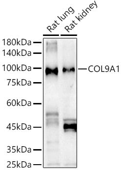Invitrogen COL9A1 Polyclonal Antibody 100 &mu;L; Unconjugated:Antibodies,