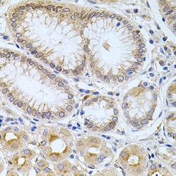 Invitrogen Carboxypeptidase M Polyclonal Antibody 100 &mu;L; Unconjugated:Antibodies,
