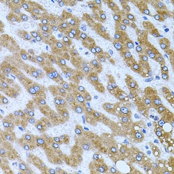 Invitrogen Carboxypeptidase M Polyclonal Antibody 100 &mu;L; Unconjugated:Antibodies,