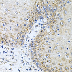 Invitrogen Carboxypeptidase M Polyclonal Antibody 100 &mu;L; Unconjugated:Antibodies,