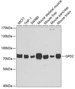 Invitrogen GPD2 Polyclonal Antibody 100 &mu;L; Unconjugated:Antibodies,