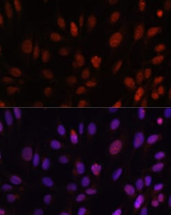 Invitrogen HOXB1 Polyclonal Antibody 100 &mu;L; Unconjugated:Antibodies,