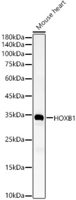 Invitrogen HOXB1 Polyclonal Antibody 100 &mu;L; Unconjugated:Antibodies,