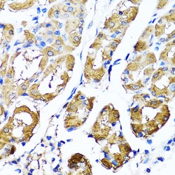 Invitrogen HYAL1 Polyclonal Antibody 100 &mu;L; Unconjugated:Antibodies,