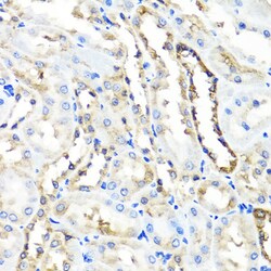 Invitrogen HYAL1 Polyclonal Antibody 100 &mu;L; Unconjugated:Antibodies,