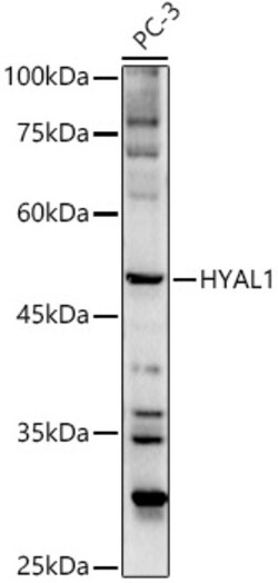 Invitrogen HYAL1 Polyclonal Antibody 100 &mu;L; Unconjugated:Antibodies,