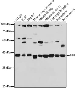 Invitrogen IHH Polyclonal Antibody 100 &mu;L; Unconjugated:Antibodies,